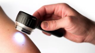 dermatoscopio dermatoscopio